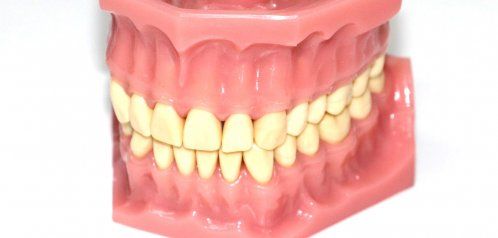 Procedimiento para encargar una prótesis dental o un elemento de confort bucal