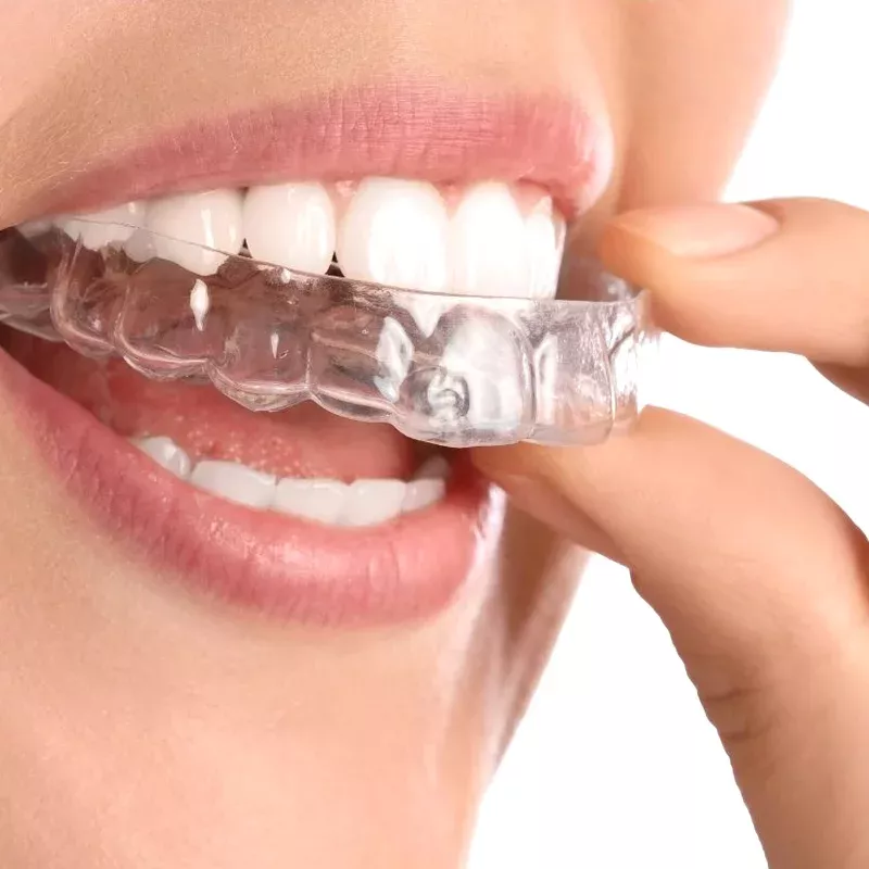 Soluciones de confort y corrección dental