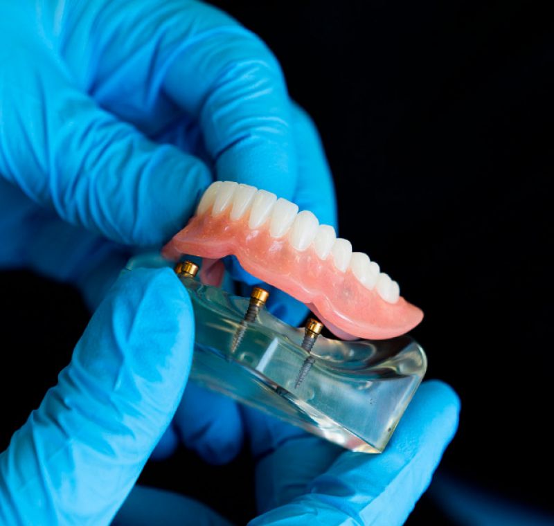 Laboratorio Dental costa Verde