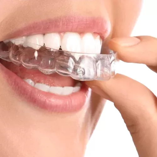 Soluciones de confort y corrección dental