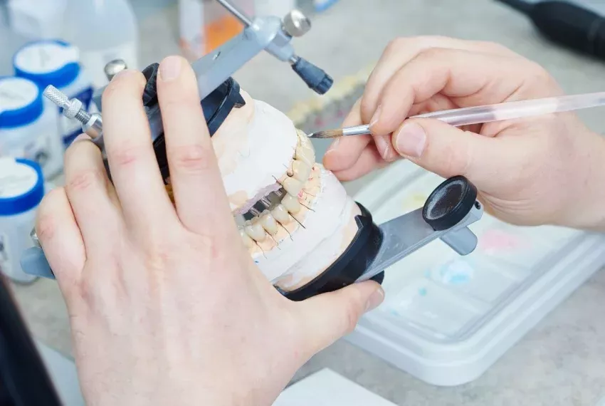 Servicios de laboratorio dental para profesionales en Gijón