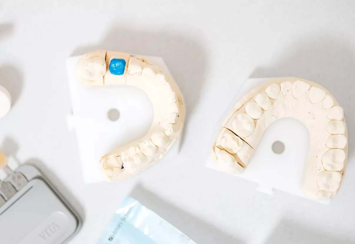 Fabricaci&oacute;n de pr&oacute;tesis dentales en laboratorio especializado